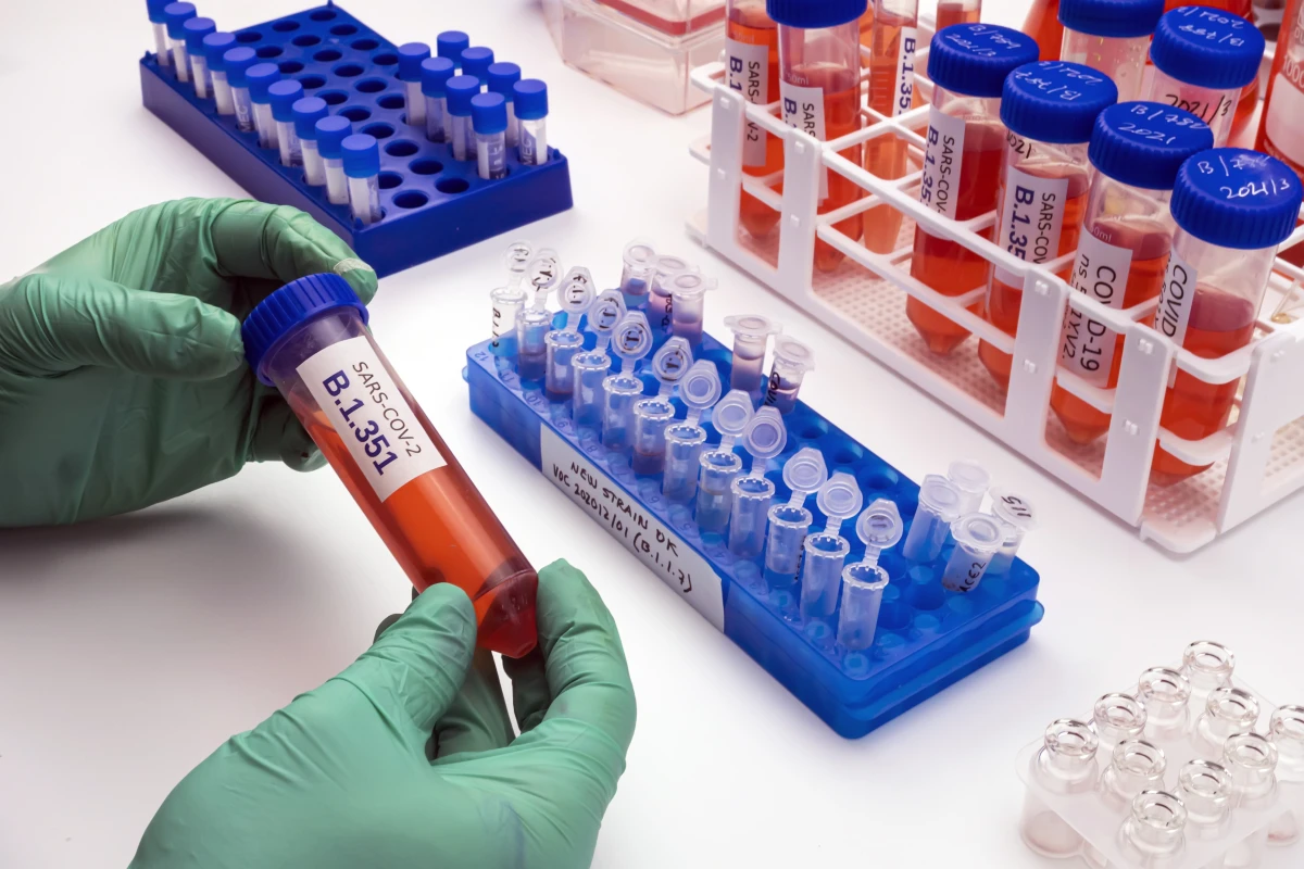 A/B testing : Optimisez votre stratégie en ligne grâce à une méthode éprouvée